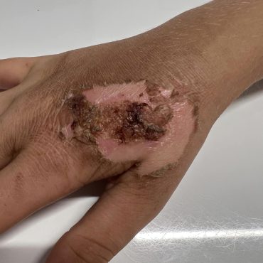 293415185_180674041009929_1454047167621643752_n